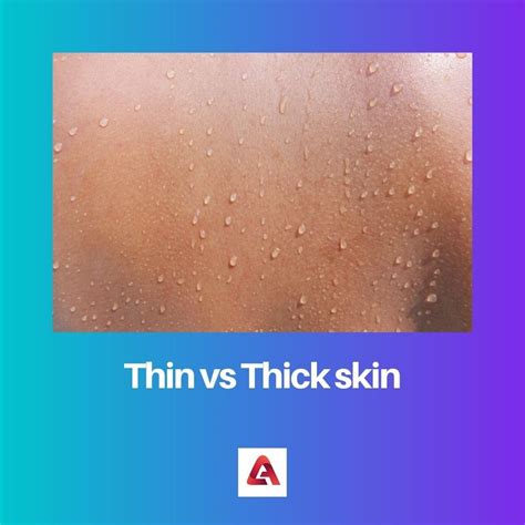 thick or thin skin test|thick skin meaning.